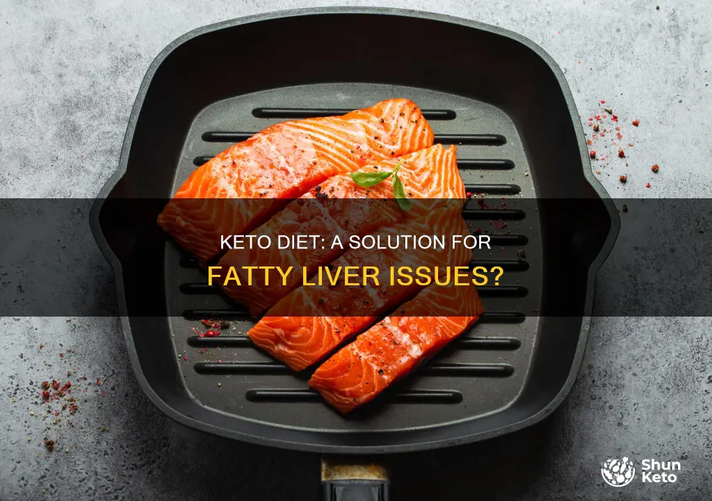 does keto diet work for fatty liver issues