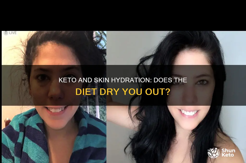 does keto dry out your skin