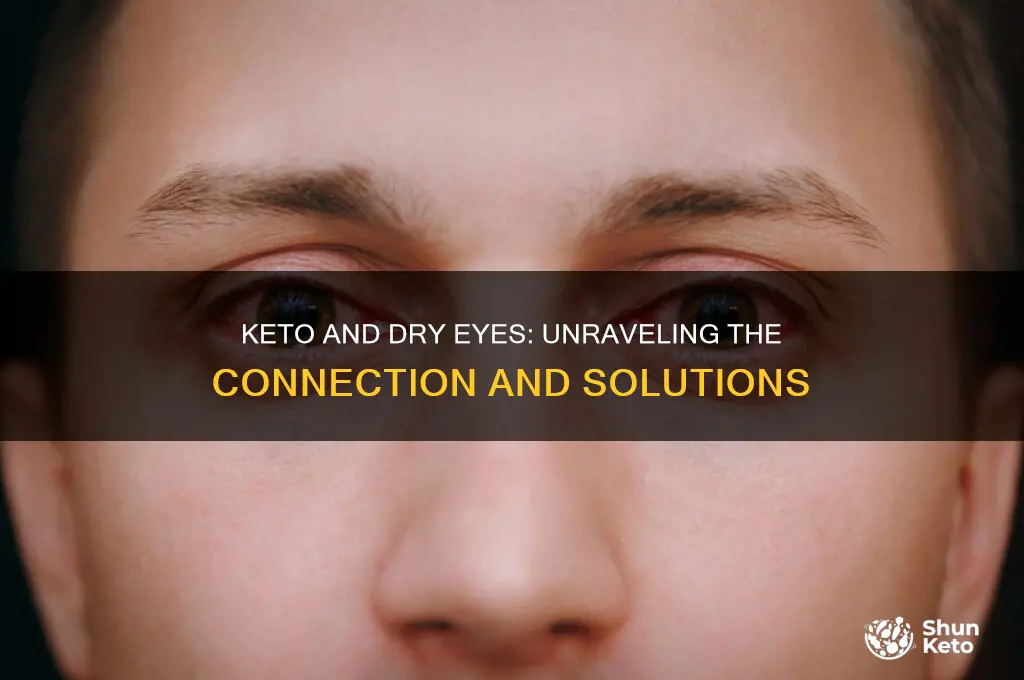 does keto give you dry eyes