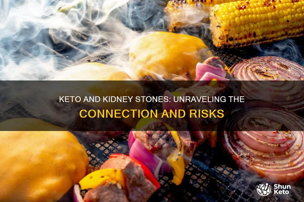 does keto give you kidney stones