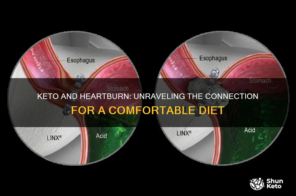 does keto give youheart burn