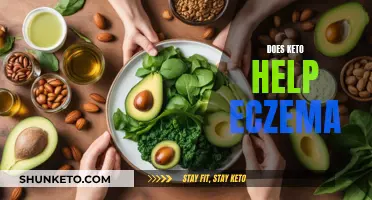 Keto Diet: Friend or Foe to Eczema?