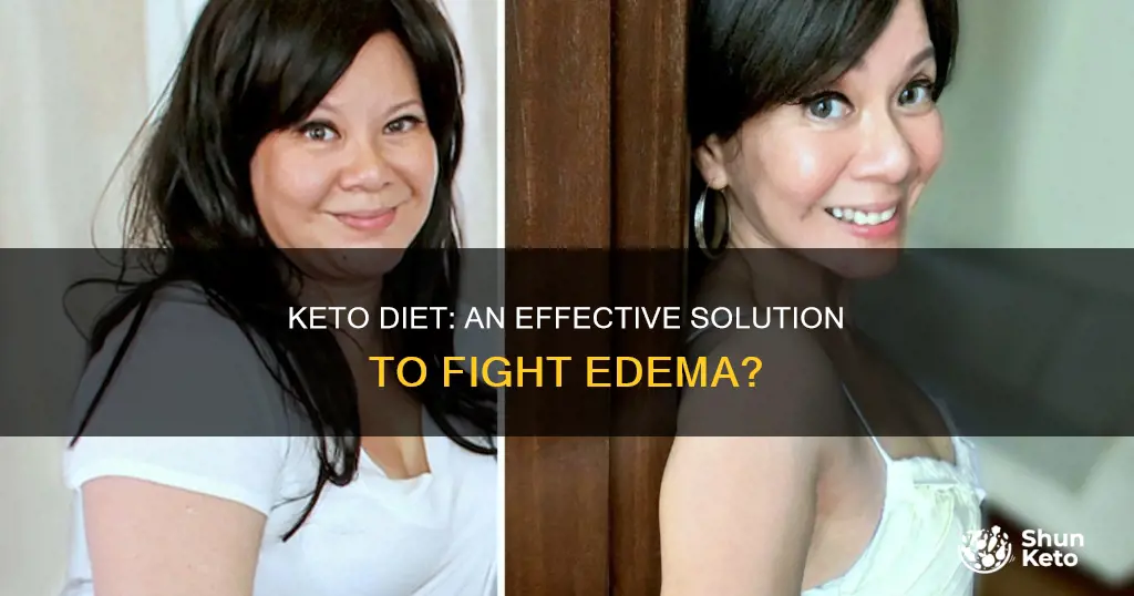 does keto help edema