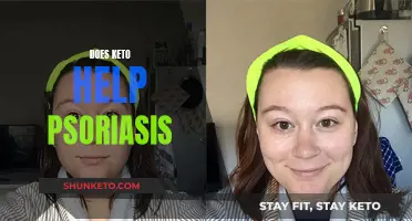 Keto Diet: Psoriasis Relief or Fad?