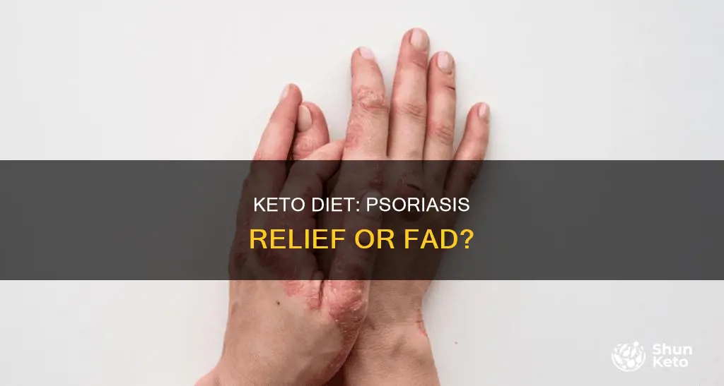 does keto help psoriasis