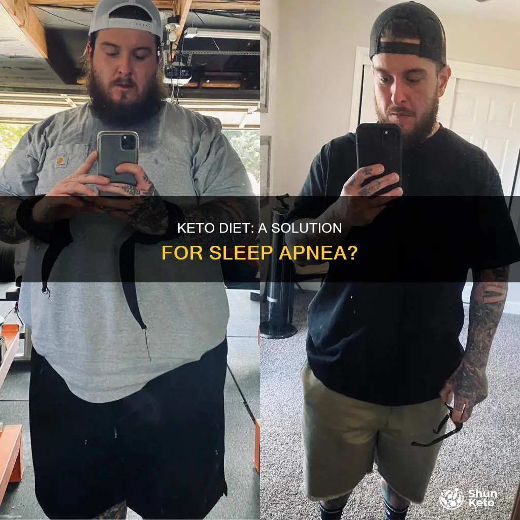 does keto help sleep apnea