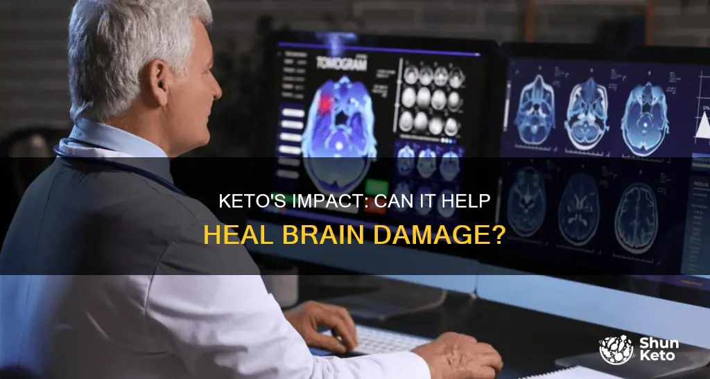 does keto help with brain damage