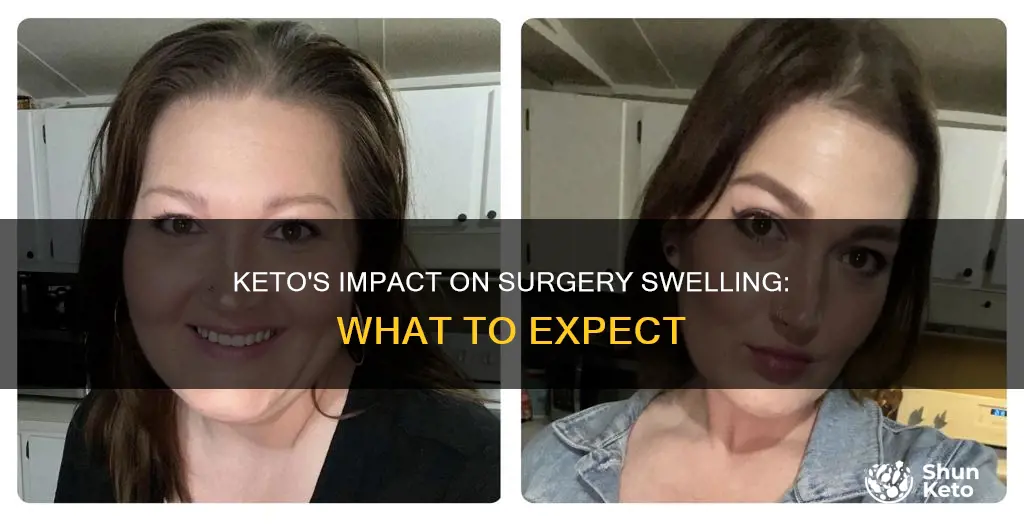 does keto help with surgery swelling