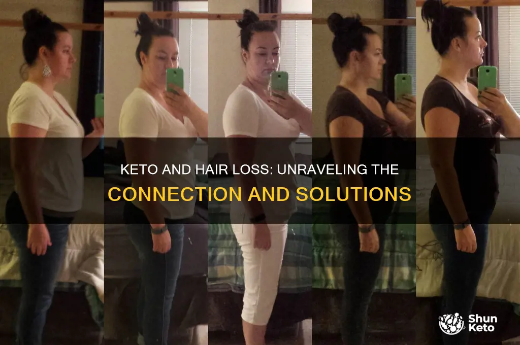 does keto lead to hair loss