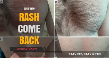 Keto Rash Recurrence: Can It Return and How to Prevent It?