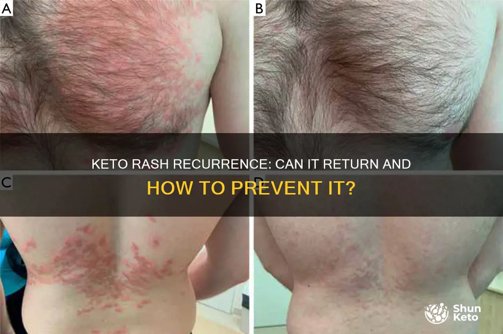 does keto rash come back