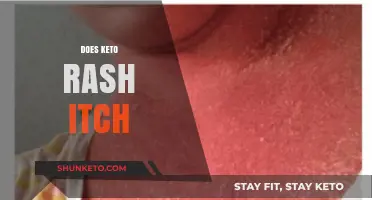 Does Keto Rash Itch? Causes, Symptoms, and Relief Tips