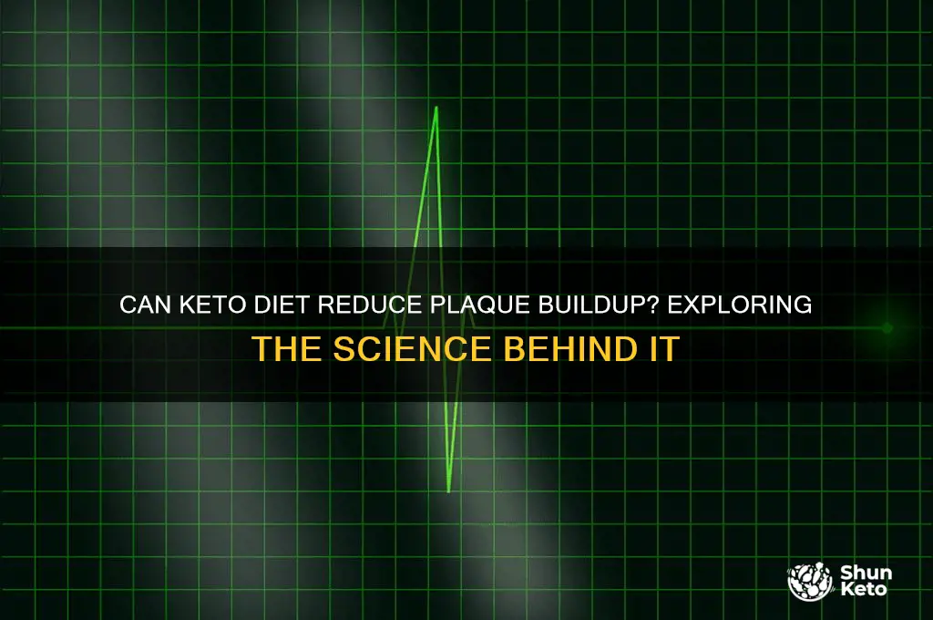 does keto remove plaque buildup