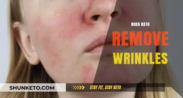 Can Keto Diet Reduce Wrinkles? Exploring Skin Benefits and Myths