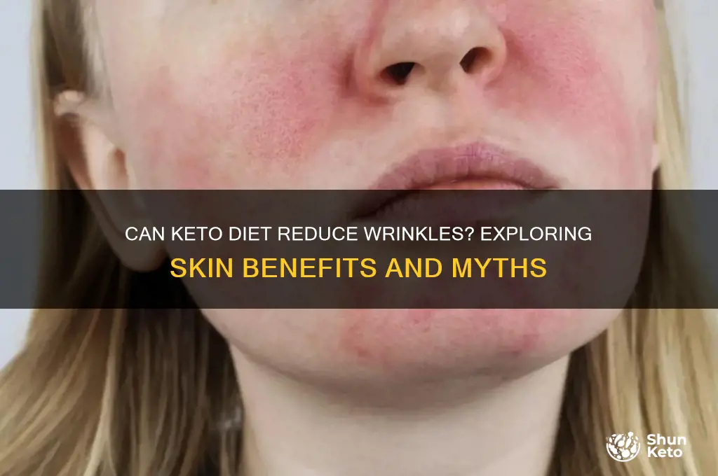 does keto remove wrinkles