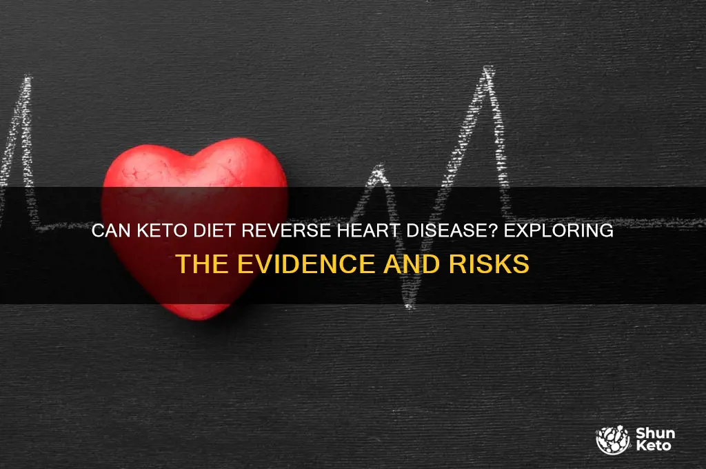 does keto reverse heart disease