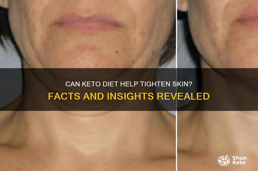 does keto tighten skin