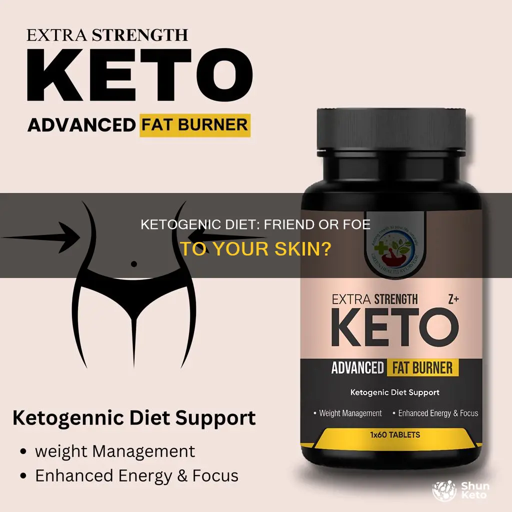 does ketogenic diet cause acne