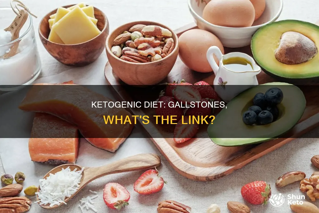 does ketogenic diet cause gall stones