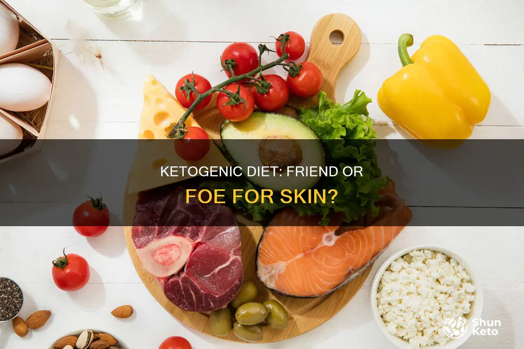 does ketogenic diet make you break out