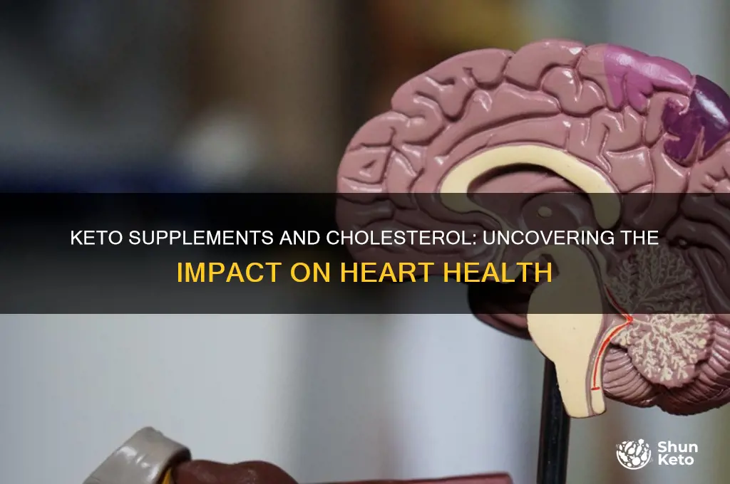 does ketos supplement increase colestroal
