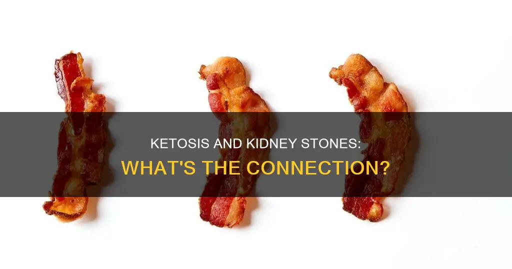 does ketosis cause kidney stones