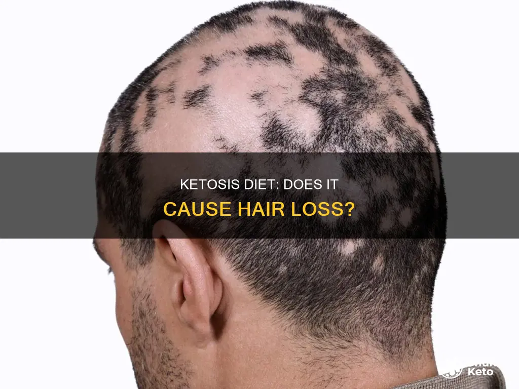 does ketosis diet cause hair loss