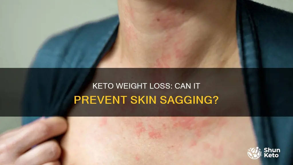 does losing weight on keto keep skin from sagging