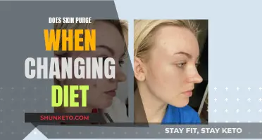 Skin Purging: Diet Changes and Their Effects