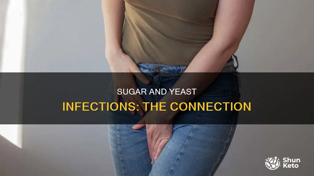 does sugar in diet increase likelihood of yeast infection