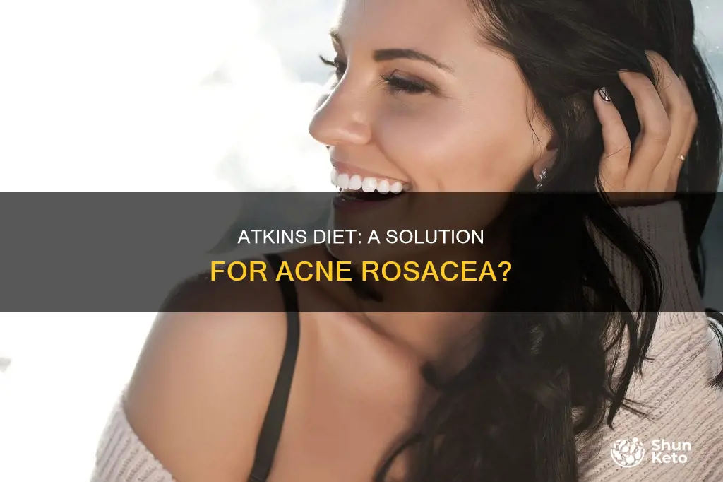 does the atkins diet help acne rosacea