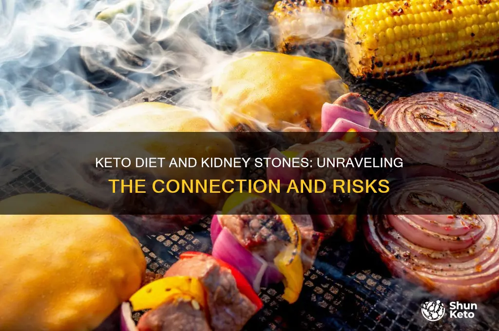 does the keto diet cause kidney stones