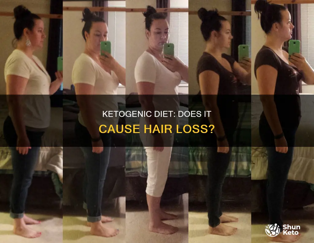 does the ketogenic diet cause hair loss