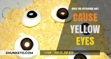 Ketogenic Diet: The Reason Behind Yellow Eyes?