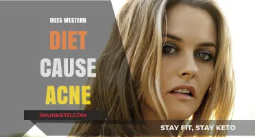 Western Diet: Acne Trigger?
