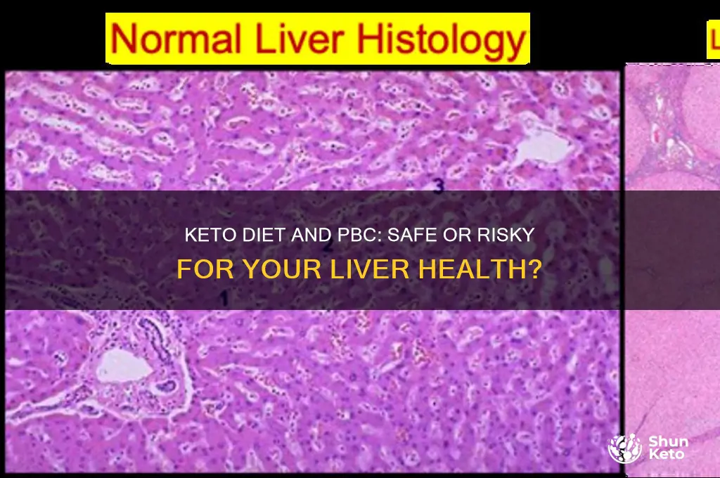 have pbc can i go on keto diet