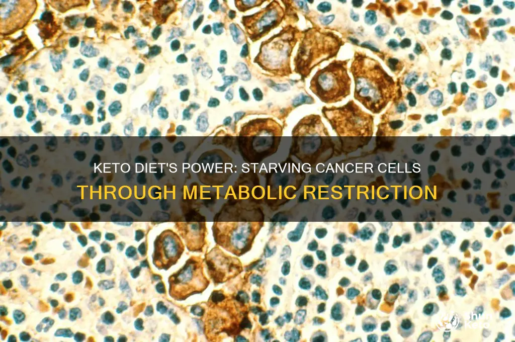 how a keto diet starves cancer cells