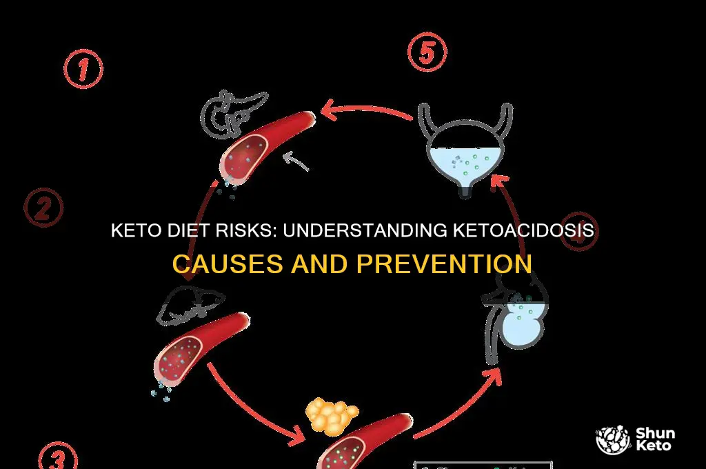 how can keto cause ketoacidosis