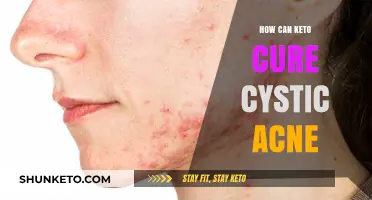 Keto Diet's Surprising Power to Heal Cystic Acne Naturally