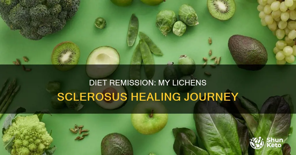 how changing my diet put my l8chen sclerosus in remission