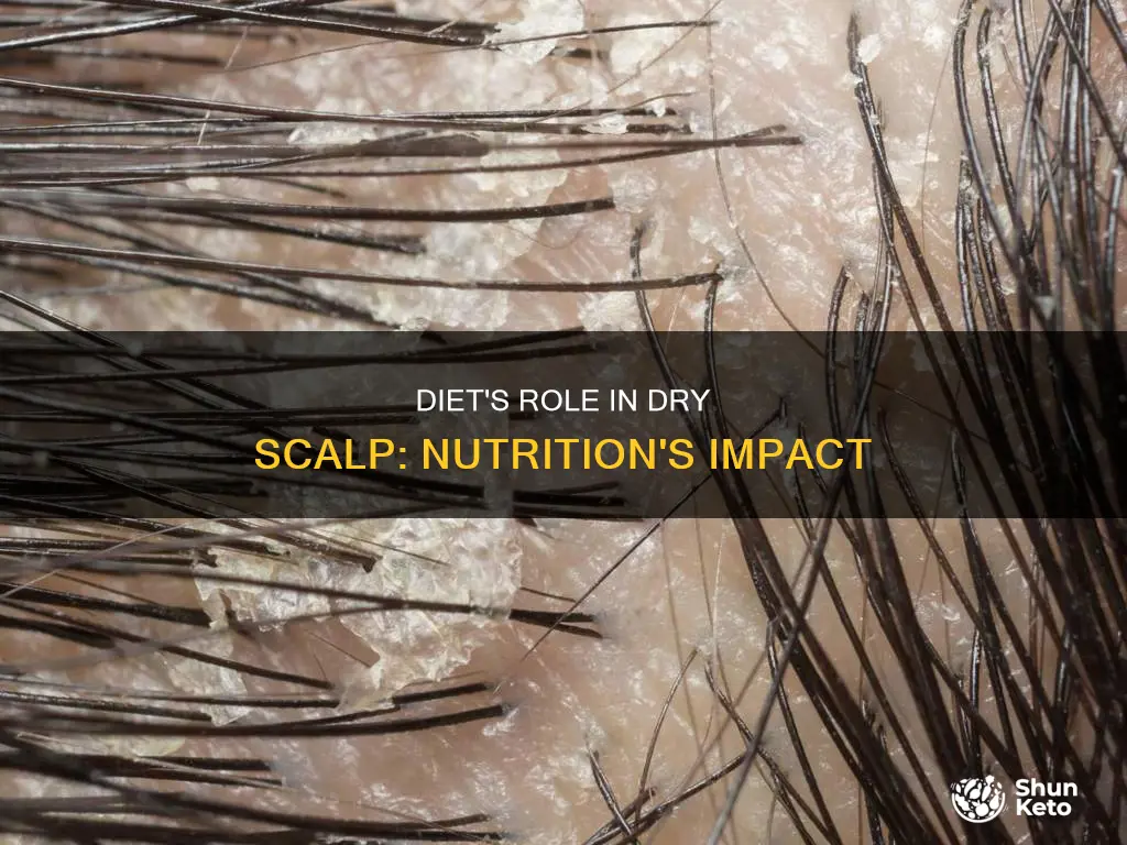 how diet causes dry scalp