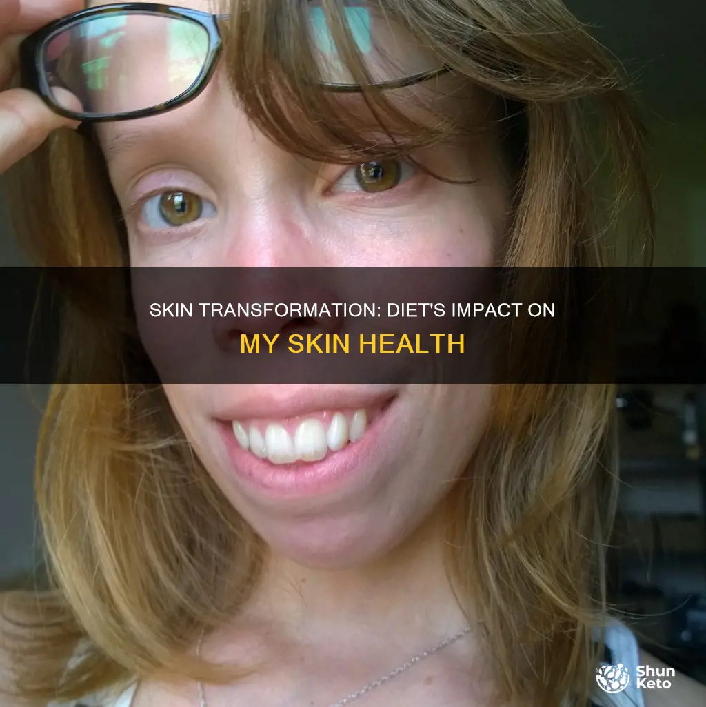 how diet changed my skin