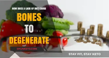 Diet Deficiency: Bone Degeneration and You