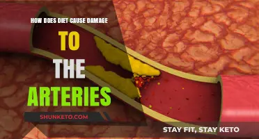 Diet's Artery Damage: What You Eat Hurts