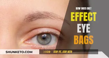Diet's Impact: Reducing Eye Bags