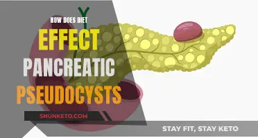 Diet's Impact on Pancreatic Pseudocysts: What You Need to Know