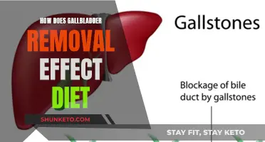 Gallbladder Removal: Dietary Changes and Challenges