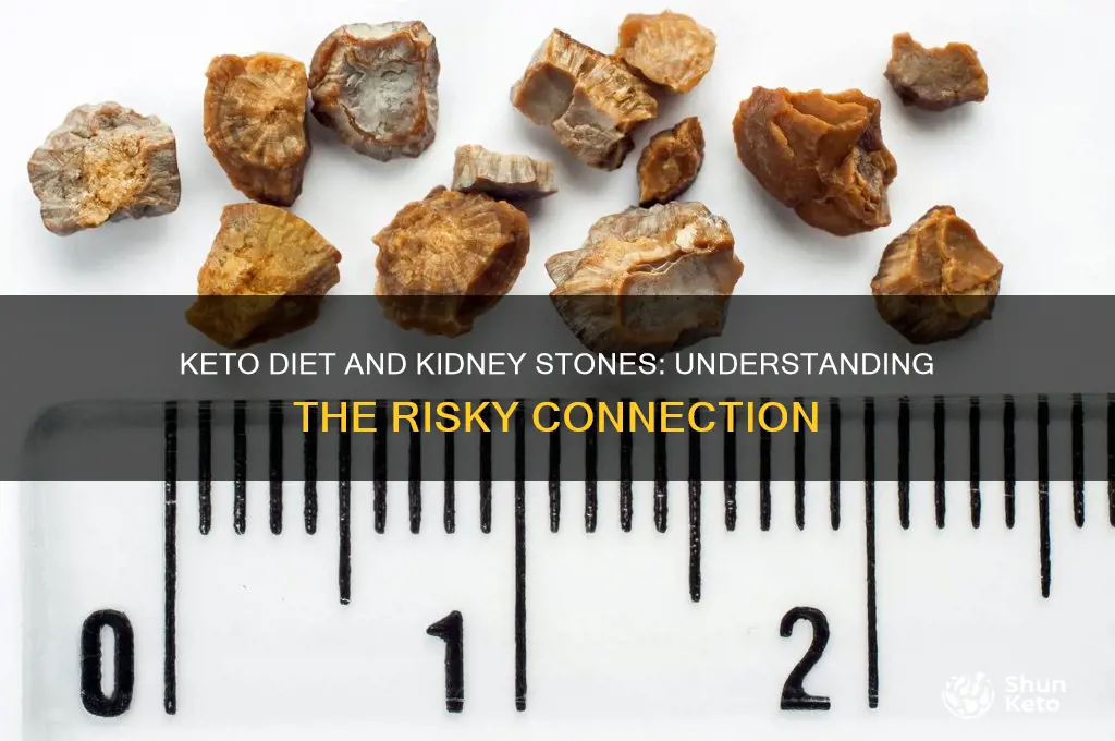 how does keto diet cause kidney stones