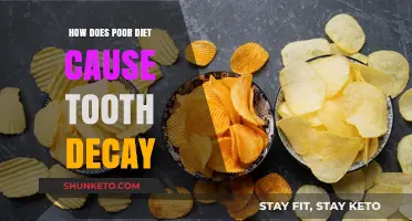 Bad Diets: A Recipe for Tooth Decay