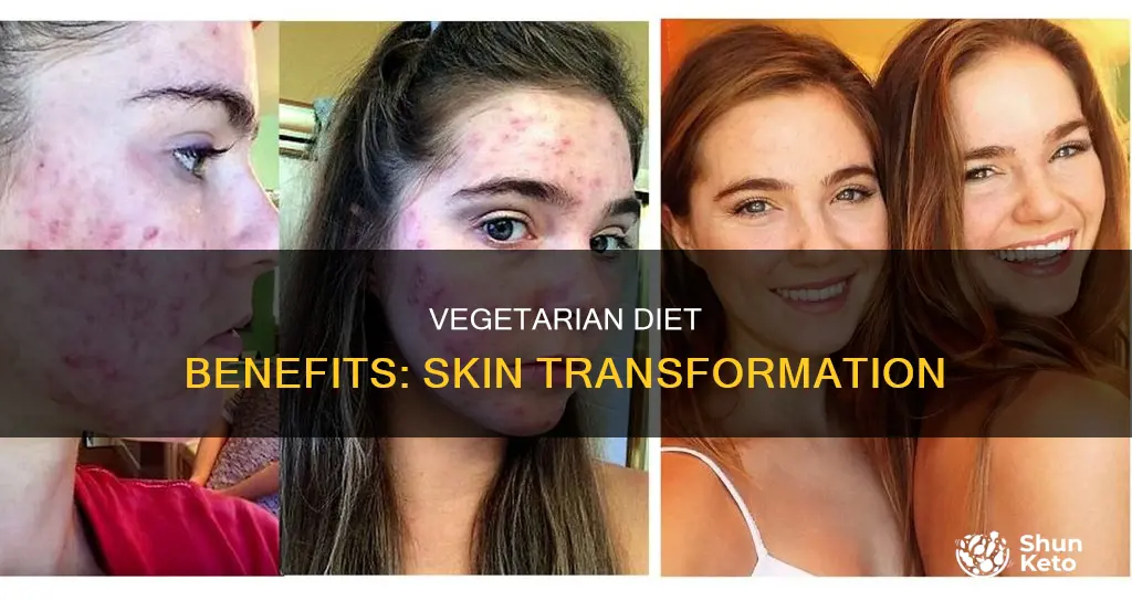 how does switching to vegetarian diet effect skin